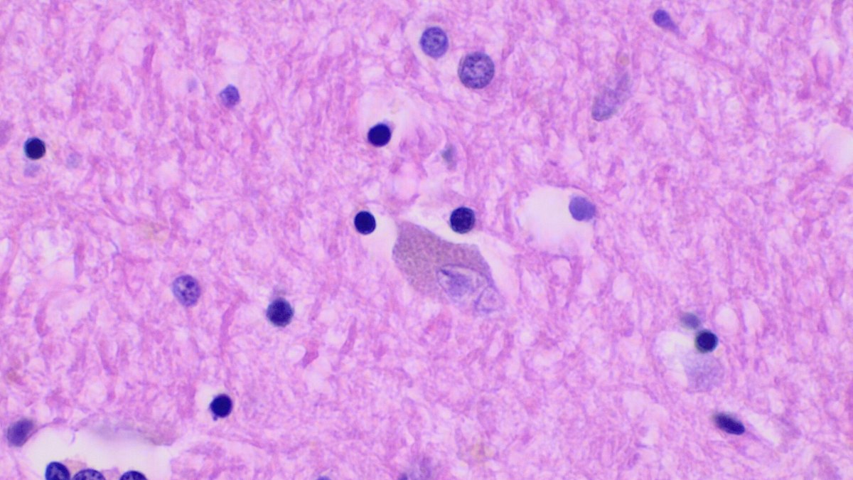 Histology of nervous-system neurons — the developing neural tissue where BRINP2, the BMP/retinoic acid-inducible neural-specific protein 2, is expressed; a Panacea Bio Chem feature by Bogdan Dicoias
